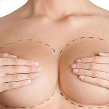 lipofilling seins Turquie