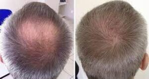 DIFFERENCE ENTRE FUE ET FUT