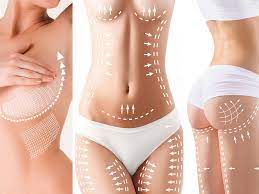 bodylift turquie
