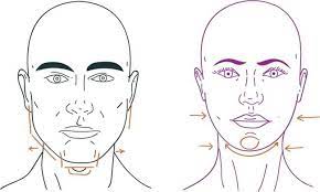 Chirurgie de féminisation faciale