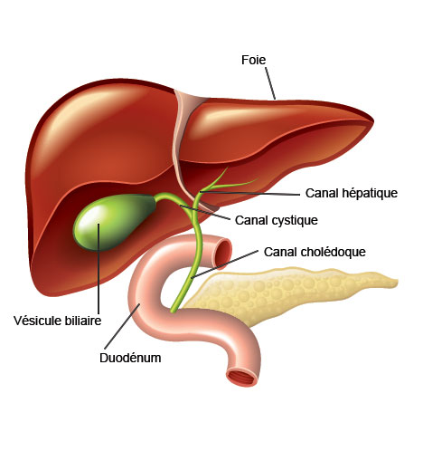 cholécystectomie en Turquie