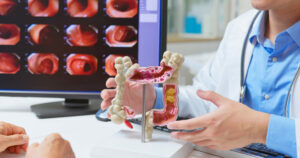 Chirurgie colorectale 